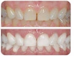 Клиника эстетической стоматологии Антона Слупицкого "Doctor Smile" предлагает полный спектр стоматологических услуг в Праге по самым высоким стандартам и доступным ценам. К каждому клиенту применяется ...