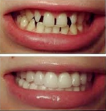 Дантисты, стоматологи объявление но. 1547633: Стоматолог, имплантация зубов в Праге